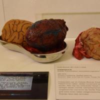 Frankenstein Experiments